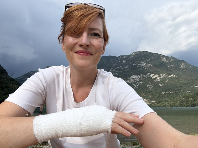 “Nesreča ne počiva … tudi na jutranjem sprehodu” – Asta Vrečko o poškodbi na dopustu